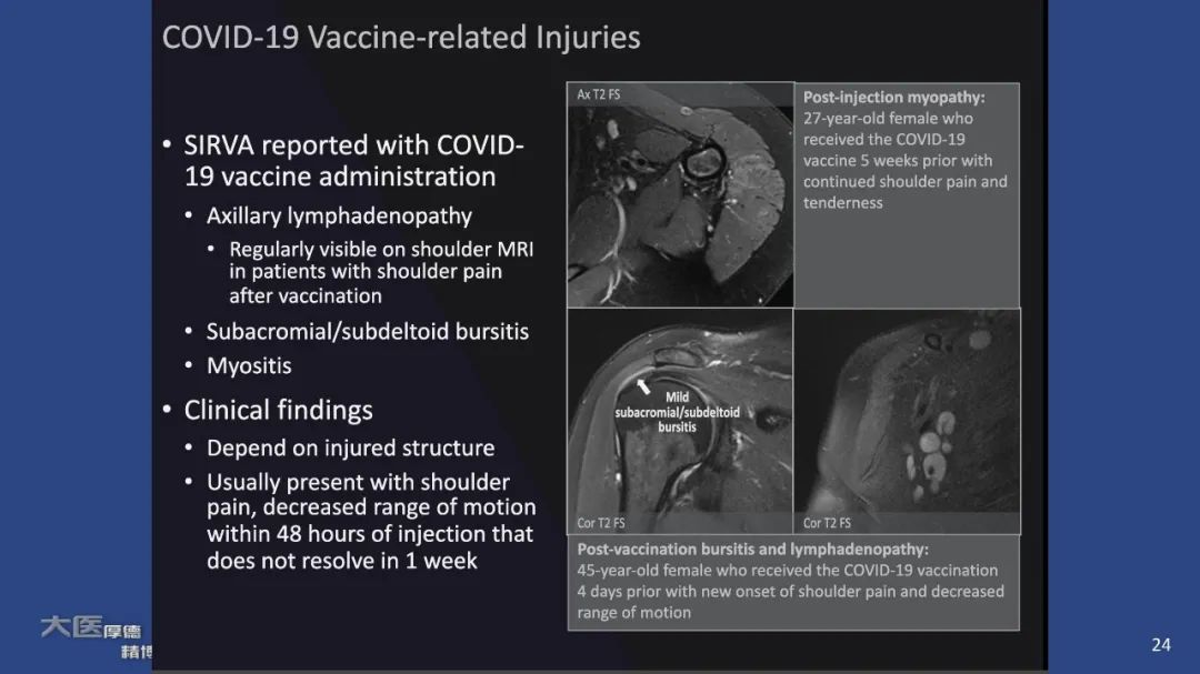 影像PPT - 【PPT】COVID-19 的肌肉骨骼表现：对目前所描述的多模态成像及临床症状的图片综述​-22