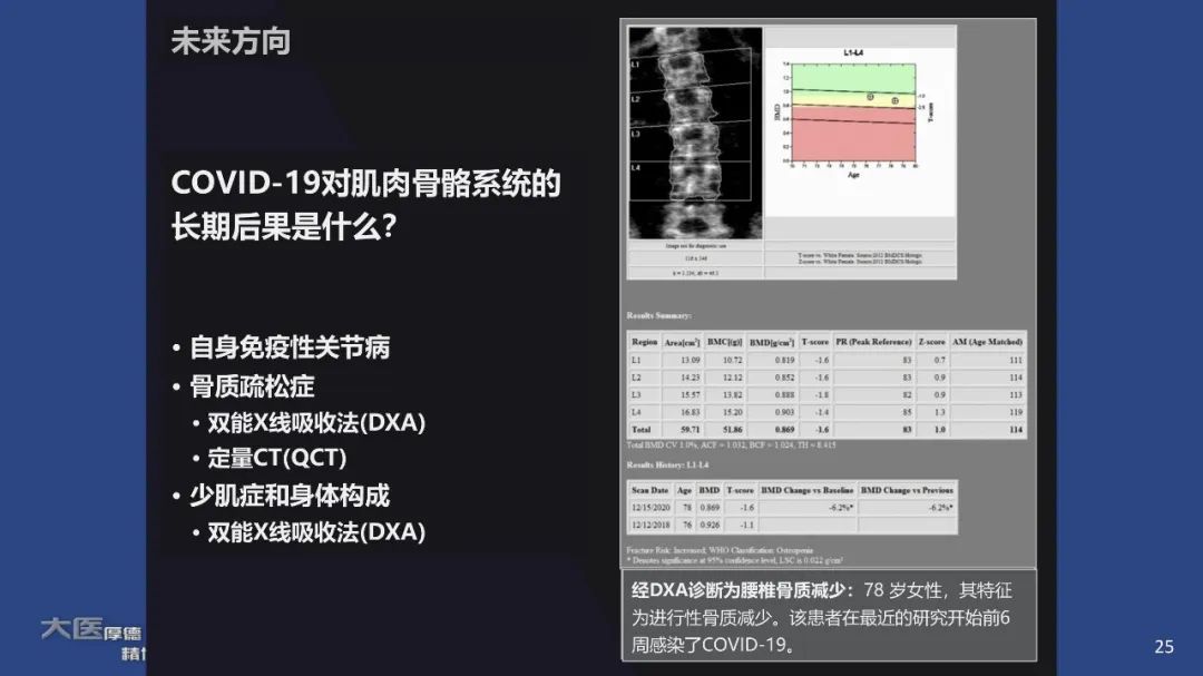 影像PPT - 【PPT】COVID-19 的肌肉骨骼表现：对目前所描述的多模态成像及临床症状的图片综述​-23