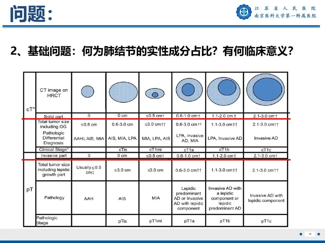 影像PPT - 【PPT】肺微浸润性腺癌-17