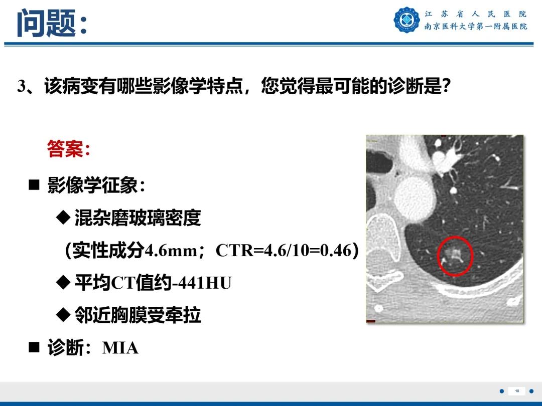 影像PPT - 【PPT】肺微浸润性腺癌-19