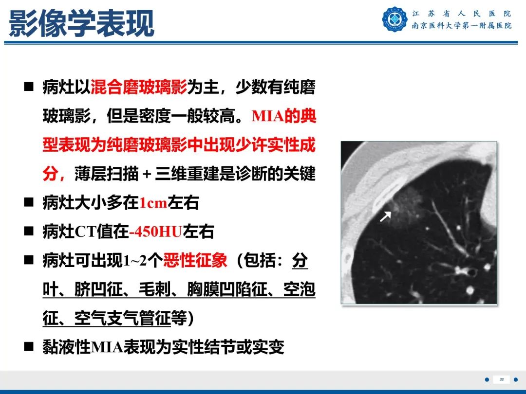 影像PPT - 【PPT】肺微浸润性腺癌-23