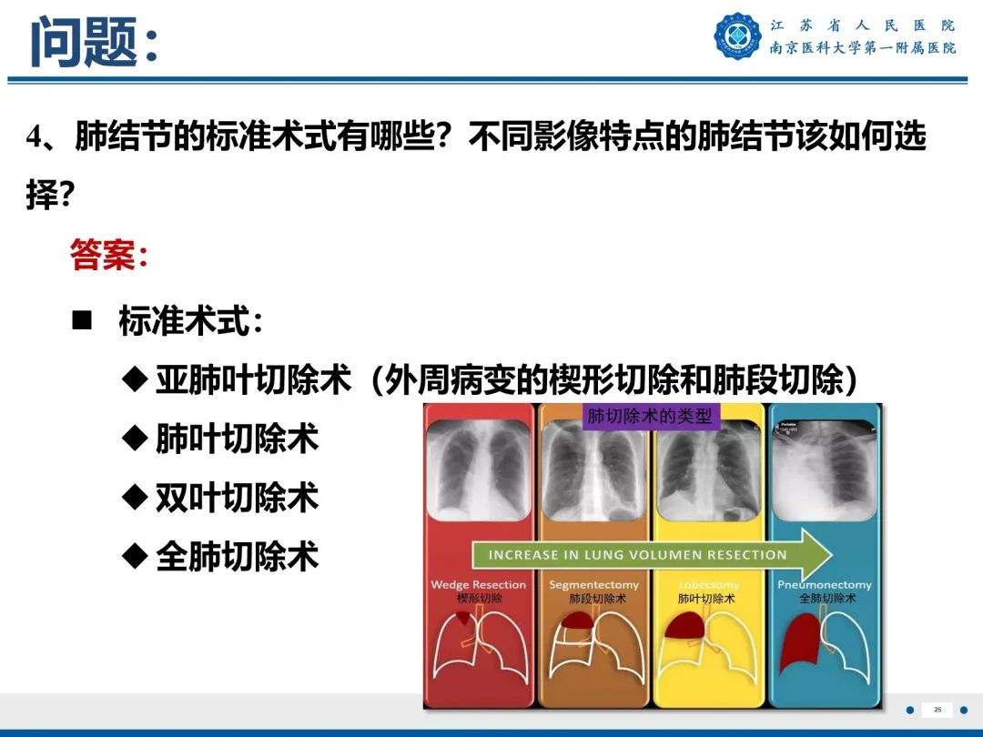 影像PPT - 【PPT】肺微浸润性腺癌-26