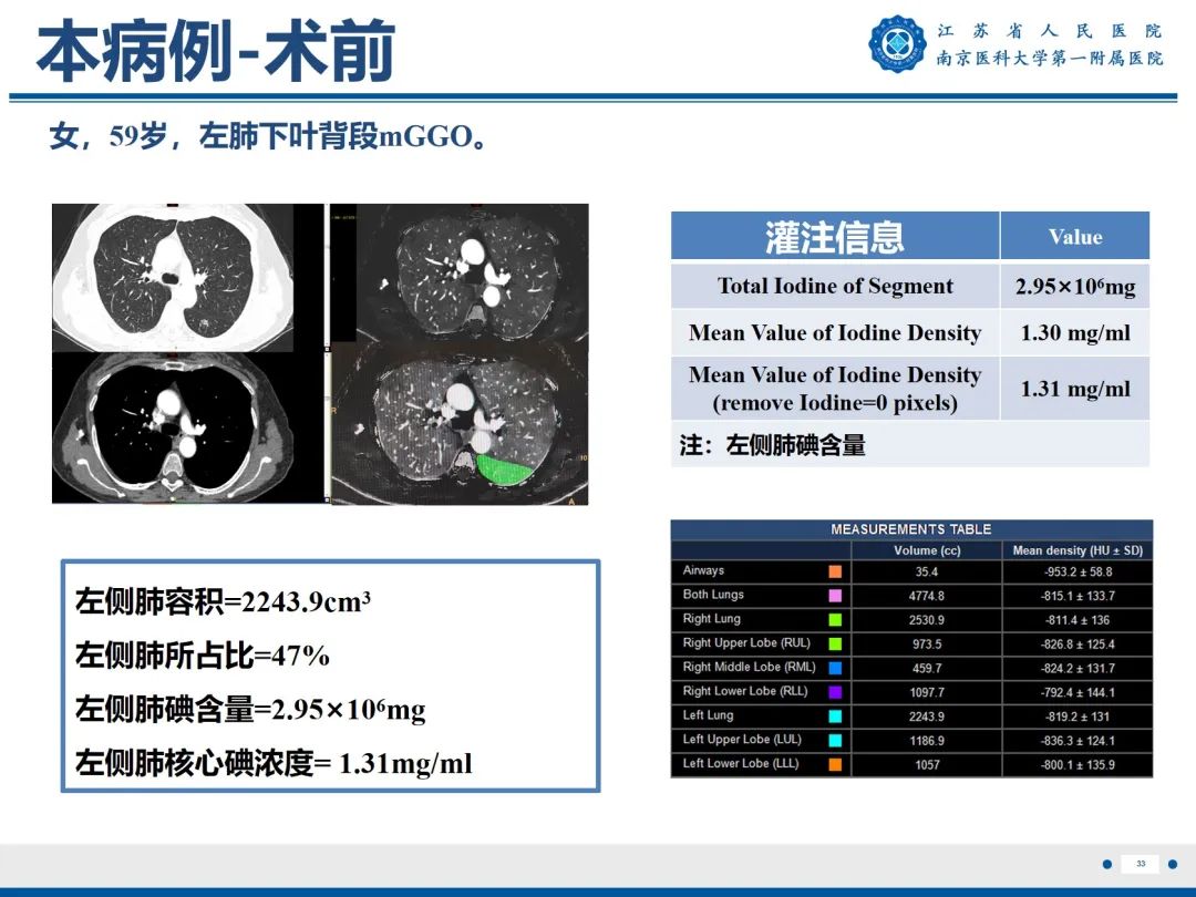 影像PPT - 【PPT】肺微浸润性腺癌-34
