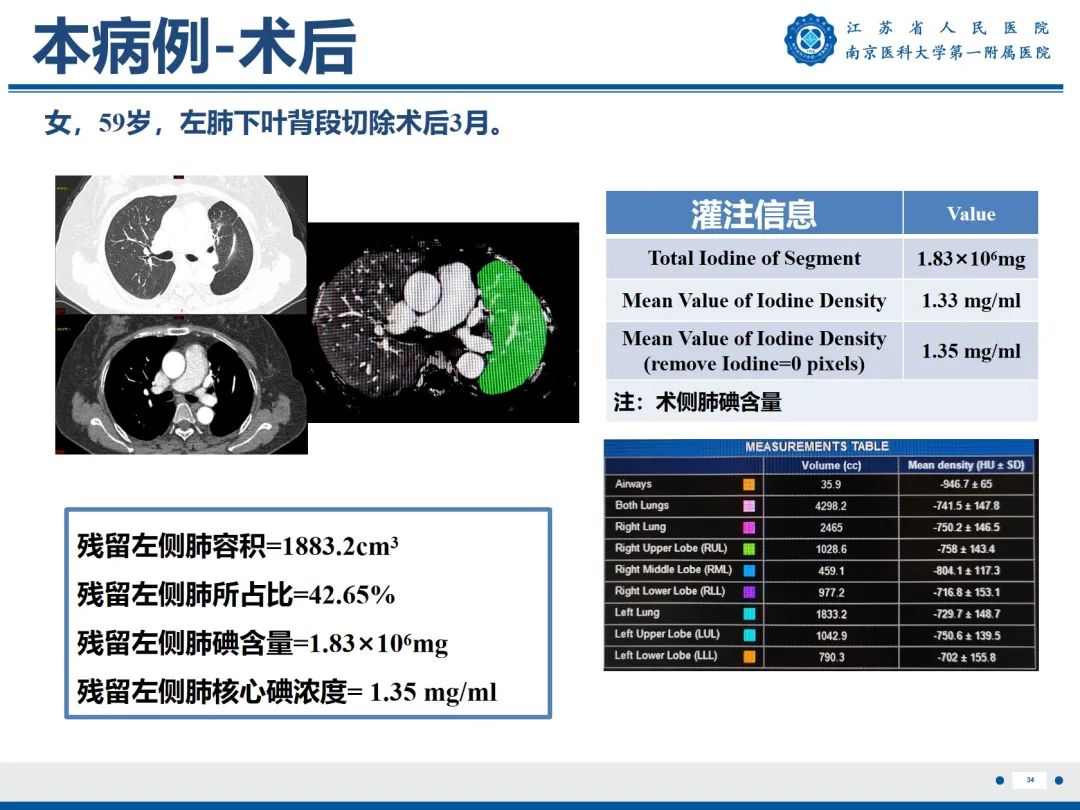影像PPT - 【PPT】肺微浸润性腺癌-35