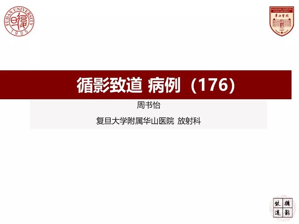 影像PPT - 【病例】小脑高级别胶质瘤1例MR-1 影像PPT - 【病例】小脑高级别胶质瘤1例MR-1