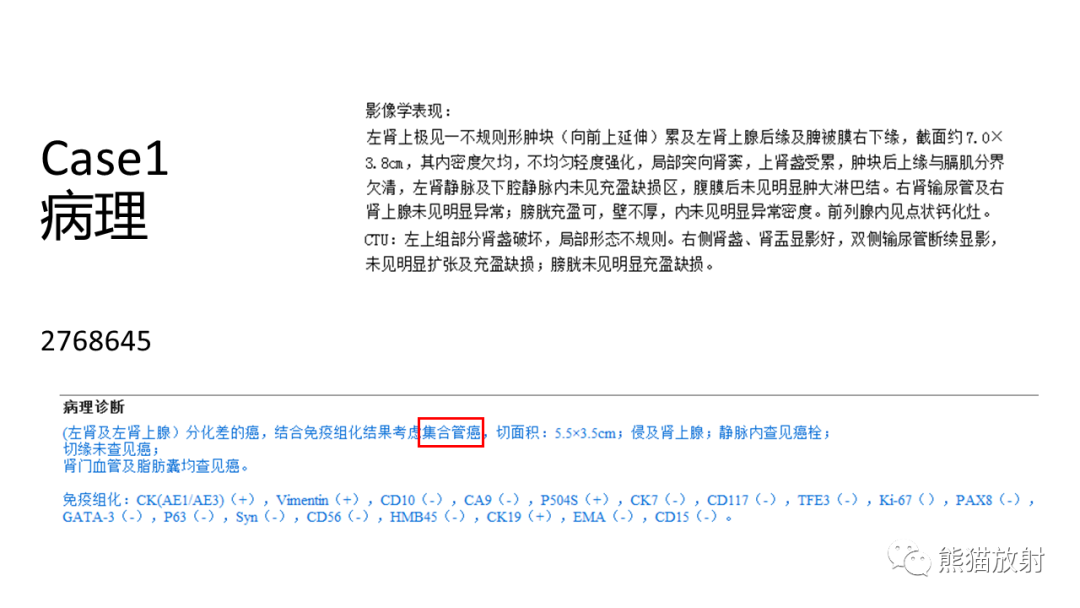 影像PPT - 【病例】肾集合管癌 VS 浸润性尿路上皮癌-10