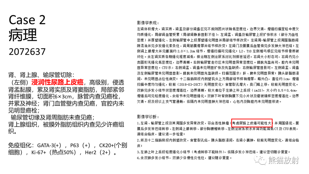 影像PPT - 【病例】肾集合管癌 VS 浸润性尿路上皮癌-11