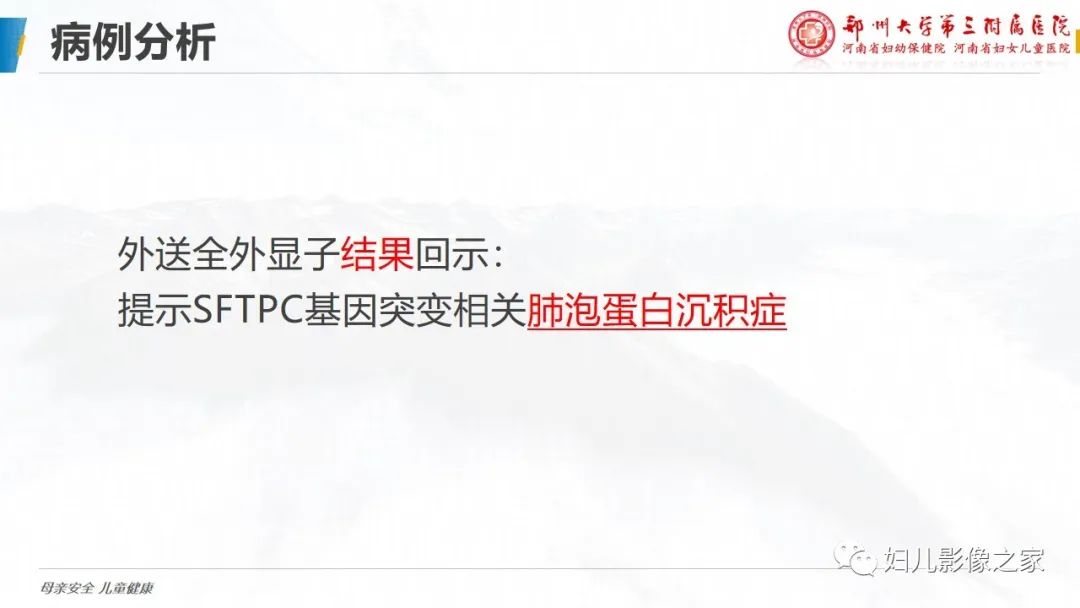 影像PPT - 【PPT】肺泡蛋白沉积症的影像诊断-6