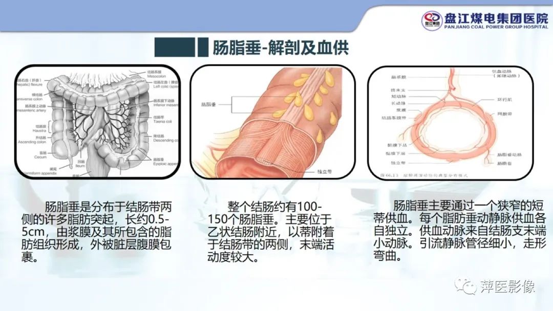 影像PPT - 【PPT】急性肠脂垂炎的CT诊断及鉴别诊断-6
