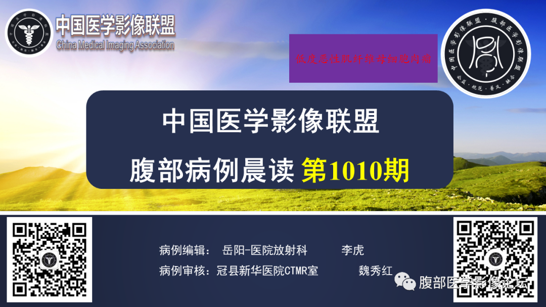 影像PPT - 【病例】腹腔低度恶性肌纤维母细胞肉瘤（LGMS）1例CT-1