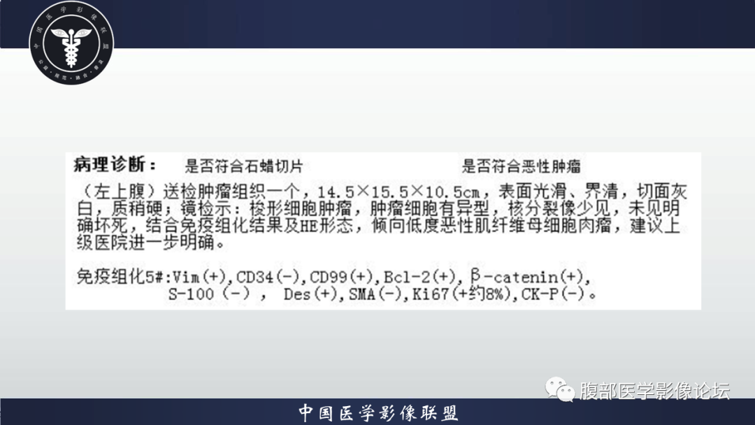 影像PPT - 【病例】腹腔低度恶性肌纤维母细胞肉瘤（LGMS）1例CT-18