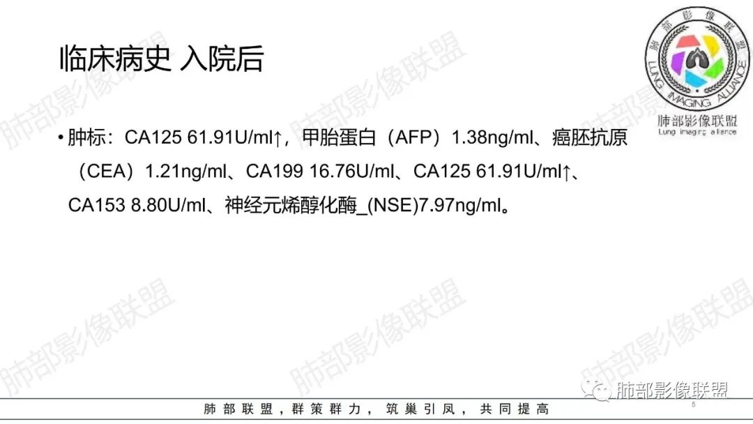 影像PPT - 【病例】肺部弥漫大B淋巴瘤病例思考及启示-5 影像PPT - 【病例】肺部弥漫大B淋巴瘤病例思考及启示-5