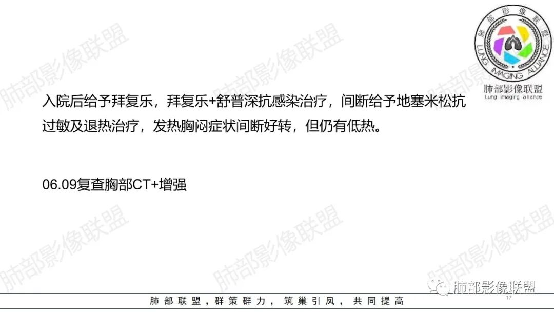 影像PPT - 【病例】肺部弥漫大B淋巴瘤病例思考及启示-17 影像PPT - 【病例】肺部弥漫大B淋巴瘤病例思考及启示-17