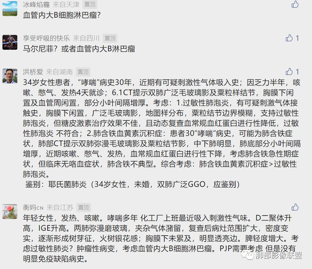影像PPT - 【病例】肺部弥漫大B淋巴瘤病例思考及启示-51 影像PPT - 【病例】肺部弥漫大B淋巴瘤病例思考及启示-51