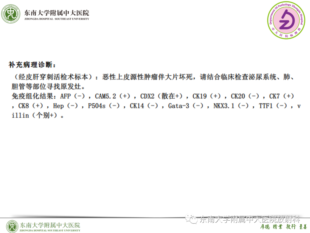 影像PPT - 【PPT】理影外合—胰腺癌鉴别诊断-52 影像PPT - 【PPT】理影外合—胰腺癌鉴别诊断-52