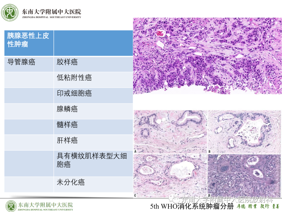影像PPT - 【PPT】理影外合—胰腺癌鉴别诊断-51 影像PPT - 【PPT】理影外合—胰腺癌鉴别诊断-51