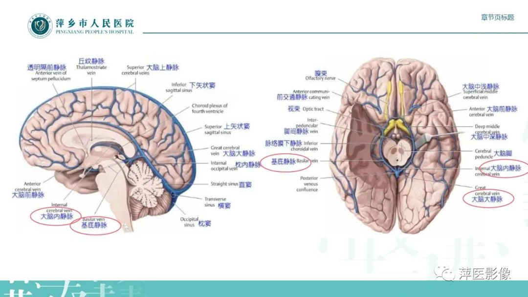 影像PPT - 【PPT】颅内静脉窦血栓形成-7