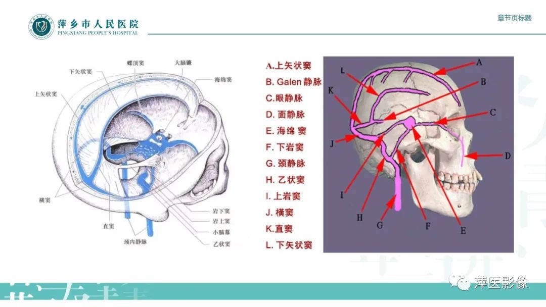 影像PPT - 【PPT】颅内静脉窦血栓形成-16