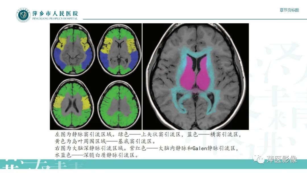 影像PPT - 【PPT】颅内静脉窦血栓形成-17