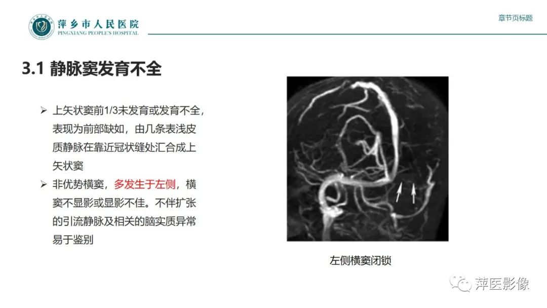 影像PPT - 【PPT】颅内静脉窦血栓形成-31