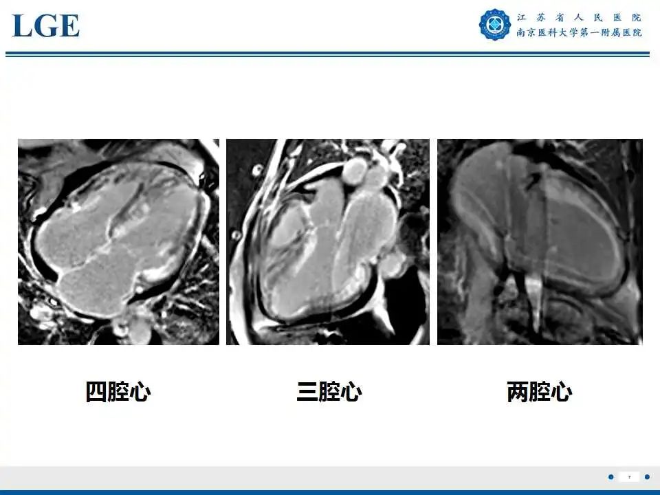 影像PPT - 【PPT】心肌淀粉样变-8