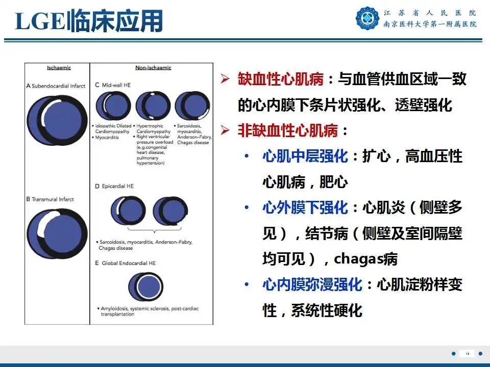 影像PPT - 【PPT】心肌淀粉样变-19