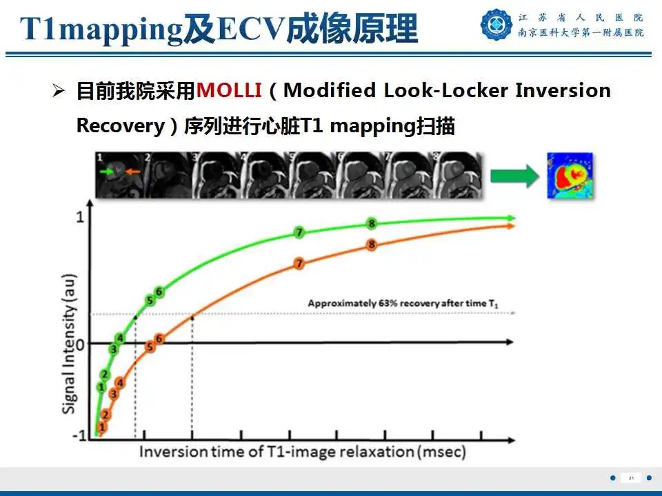 影像PPT - 【PPT】心肌淀粉样变-22