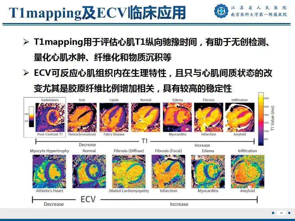 影像PPT - 【PPT】心肌淀粉样变-27