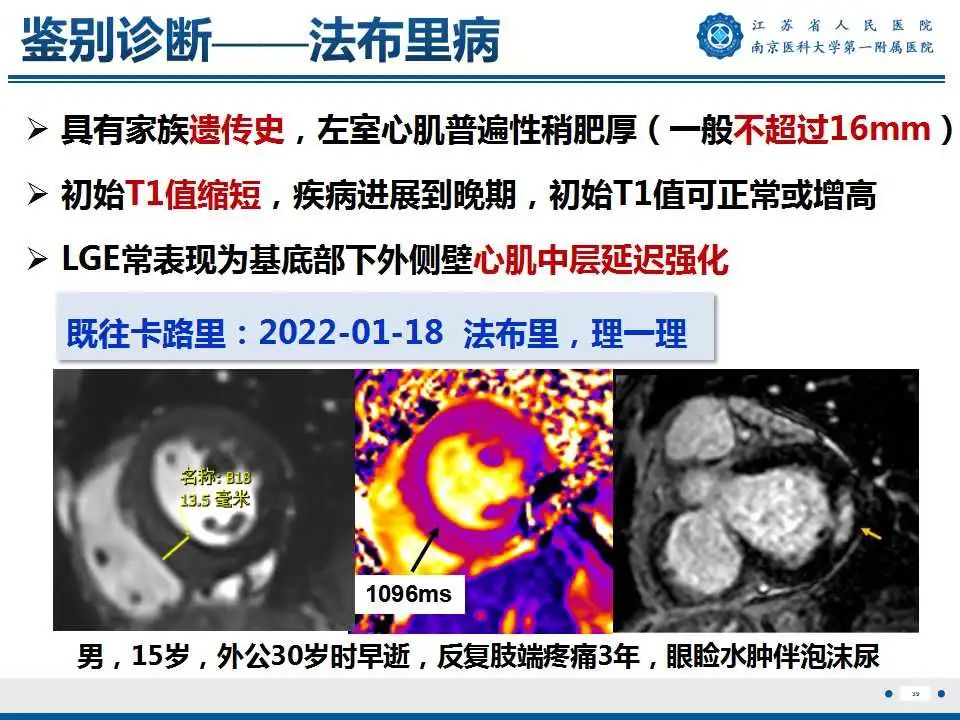 影像PPT - 【PPT】心肌淀粉样变-40