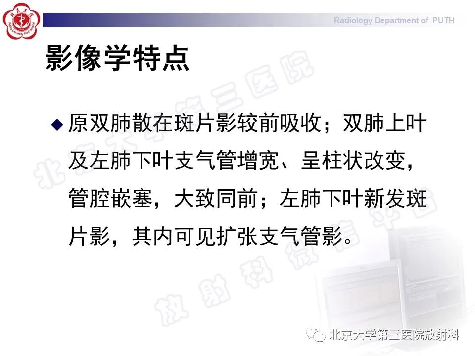 影像PPT - 【PPT】变态反应性支气管肺曲霉菌病-9