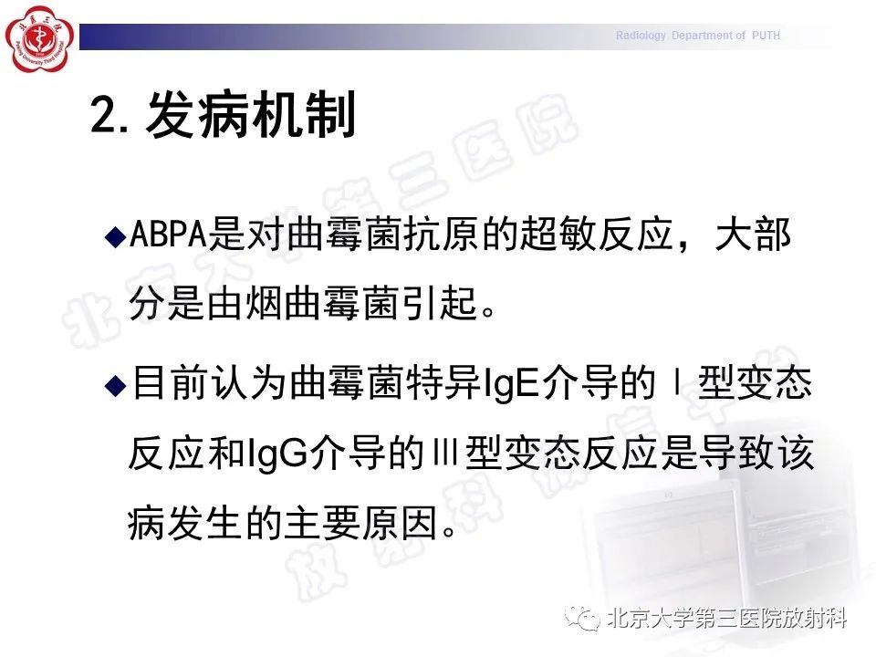 影像PPT - 【PPT】变态反应性支气管肺曲霉菌病-15