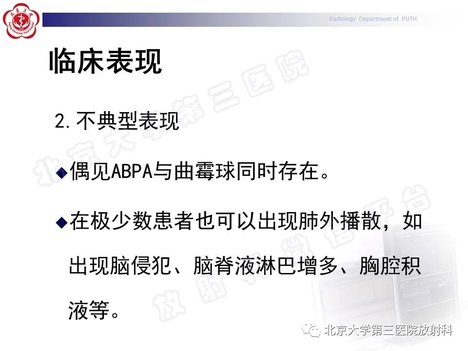 影像PPT - 【PPT】变态反应性支气管肺曲霉菌病-19