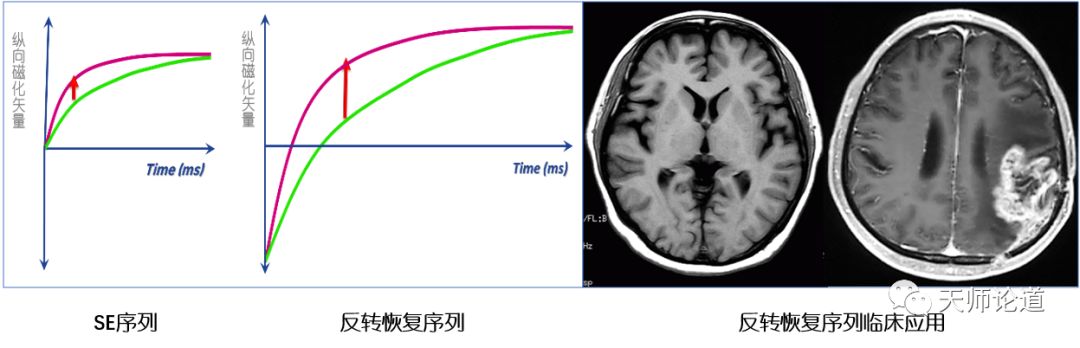 影像PPT - 组织信号怎么抑制?论反转恢复自旋回波序列:STIR、T1 FLAIR、T2 FLAIR-2 影像PPT - 组织信号怎么抑制?论反转恢复自旋回波序列:STIR、T1 FLAIR、T2 FLAIR-2