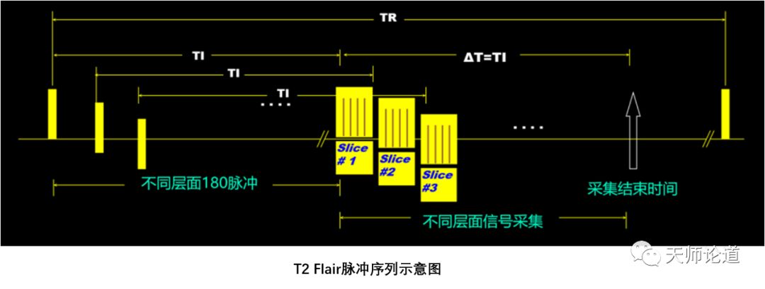 影像PPT - 组织信号怎么抑制?论反转恢复自旋回波序列:STIR、T1 FLAIR、T2 FLAIR-4 影像PPT - 组织信号怎么抑制?论反转恢复自旋回波序列:STIR、T1 FLAIR、T2 FLAIR-4