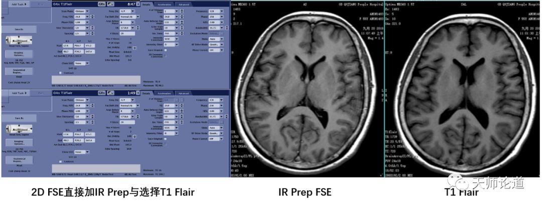 影像PPT - 组织信号怎么抑制?论反转恢复自旋回波序列:STIR、T1 FLAIR、T2 FLAIR-3 影像PPT - 组织信号怎么抑制?论反转恢复自旋回波序列:STIR、T1 FLAIR、T2 FLAIR-3