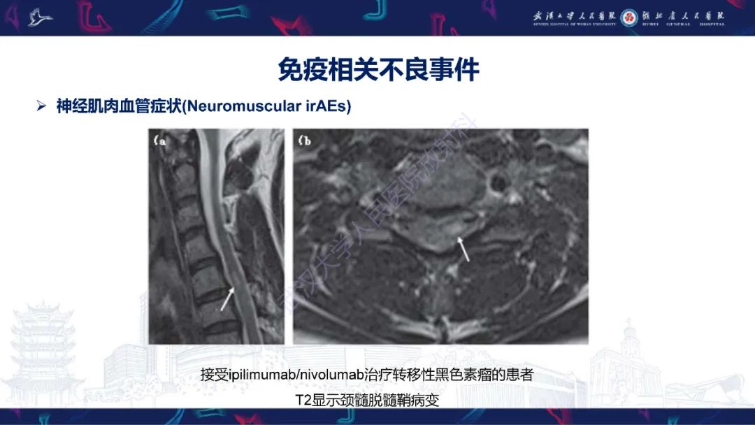 影像PPT - 【PPT】肿瘤免疫治疗疗效及不良事件影像评估-21