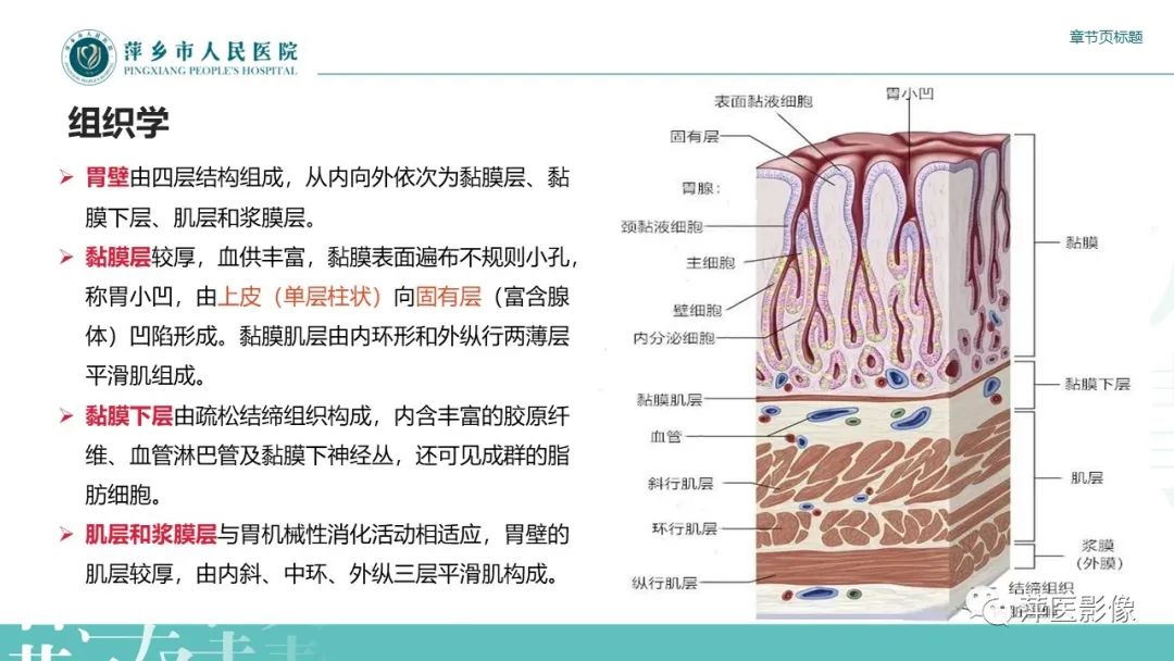 影像PPT - 【PPT】胃癌影像表现及鉴别诊断-5