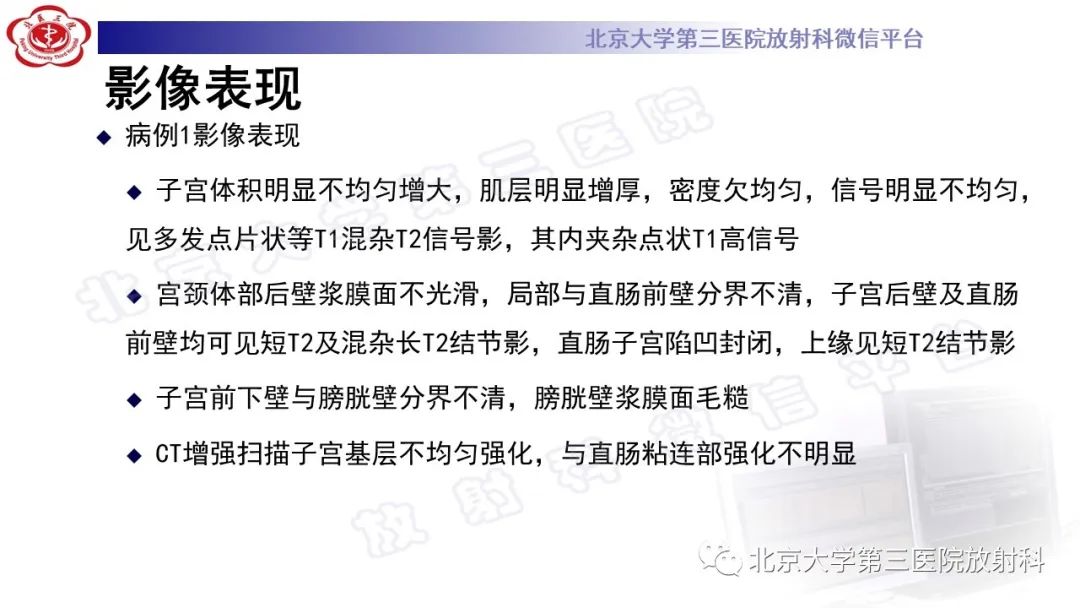 影像PPT - 【PPT】深部浸润型子宫内膜异位症-8