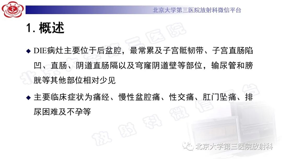 影像PPT - 【PPT】深部浸润型子宫内膜异位症-14
