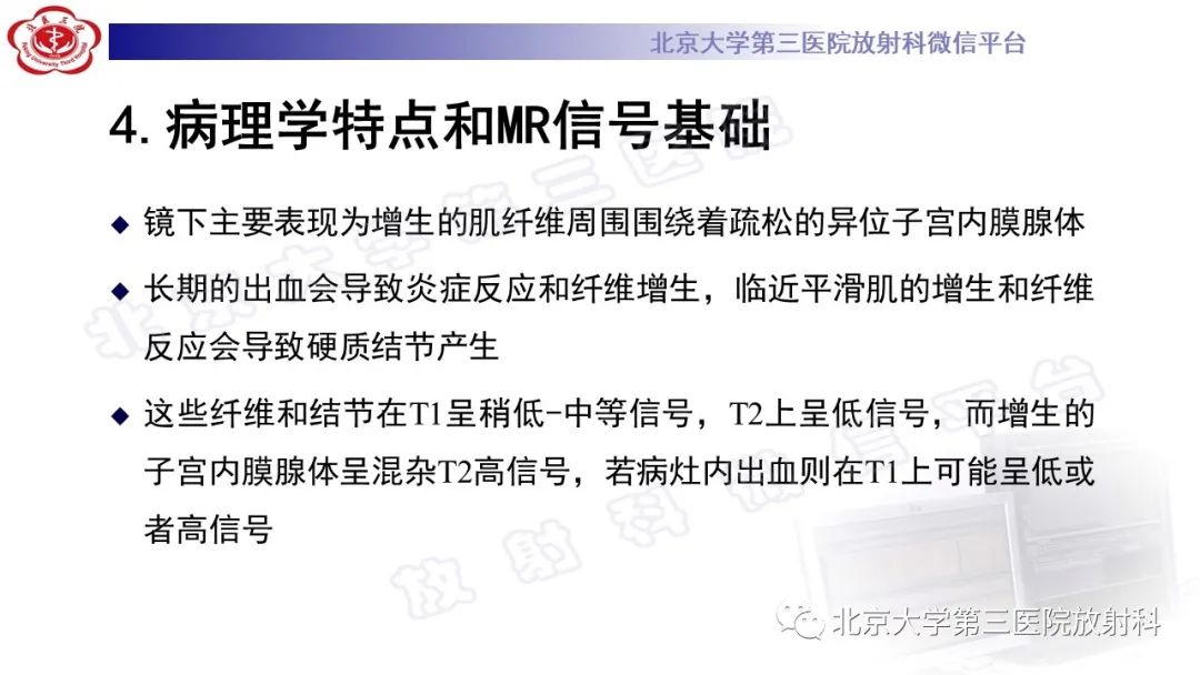 影像PPT - 【PPT】深部浸润型子宫内膜异位症-20