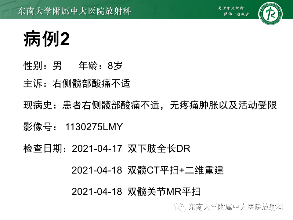 影像PPT - 【PPT】骨巨细胞瘤-20