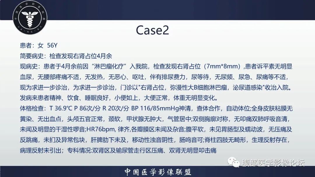 影像PPT - 【病例】肾脏嗜酸细胞腺瘤-1
