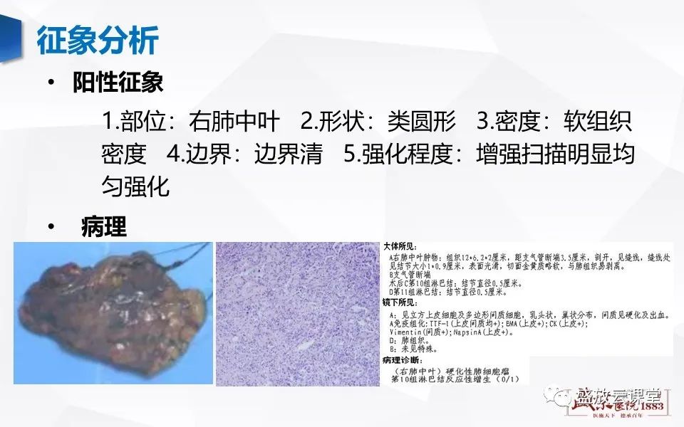 影像PPT - 【病例】肺错构瘤 VS 肺硬化性血管瘤-22