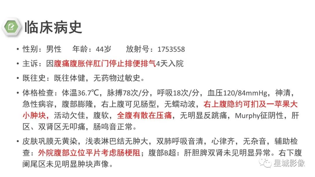影像PPT - 【病例】腹茧症1例影像表现-2