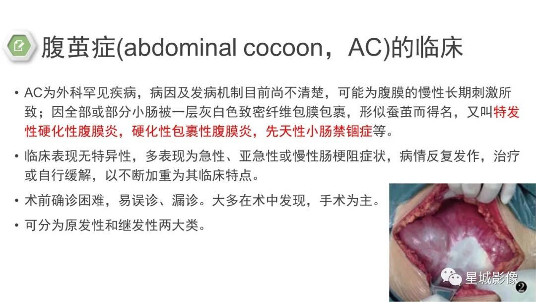 影像PPT - 【病例】腹茧症1例影像表现-15