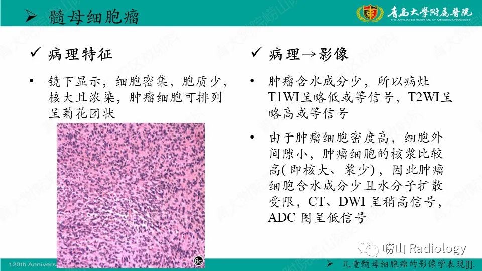 影像PPT - 【病例】髓母细胞瘤1例CT及MR-23