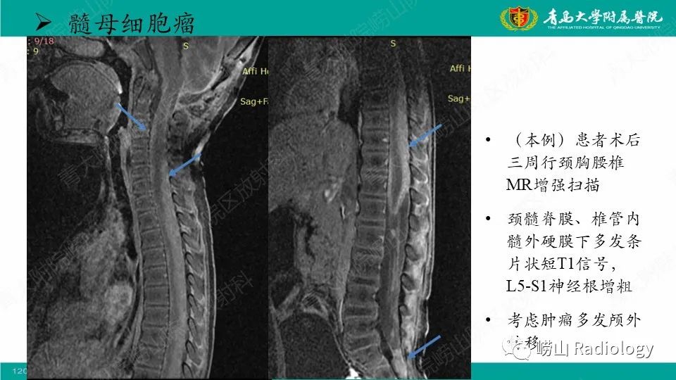 影像PPT - 【病例】髓母细胞瘤1例CT及MR-31
