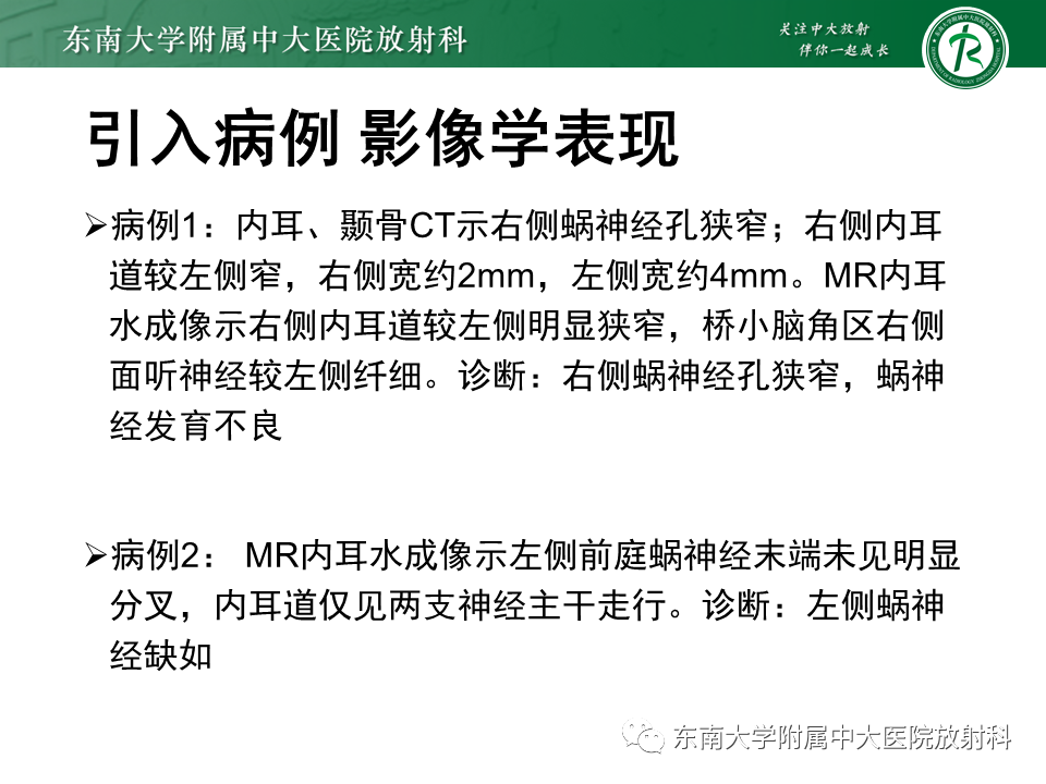 影像PPT - 【PPT】蜗神经发育不良-6 影像PPT - 【PPT】蜗神经发育不良-6