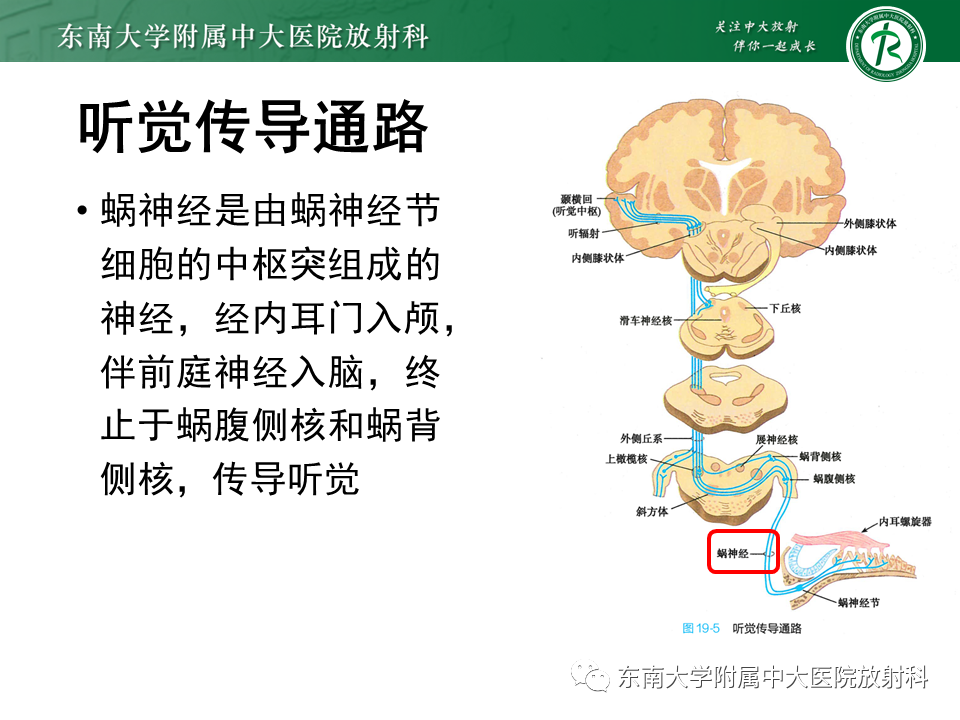 影像PPT - 【PPT】蜗神经发育不良-9 影像PPT - 【PPT】蜗神经发育不良-9