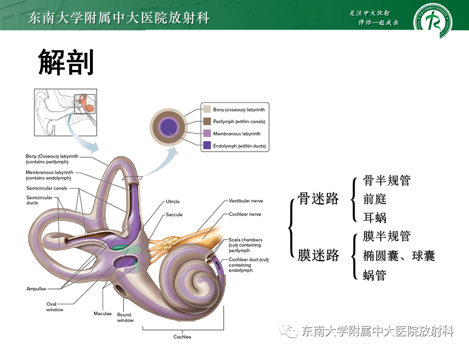 影像PPT - 【PPT】蜗神经发育不良-11 影像PPT - 【PPT】蜗神经发育不良-11